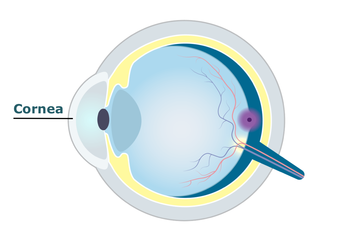 Eye diagram showing the cornea