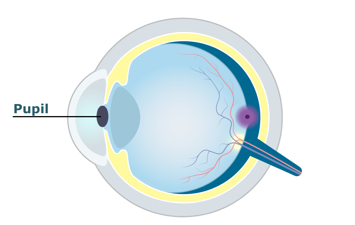 Eye diagram showing the pupil